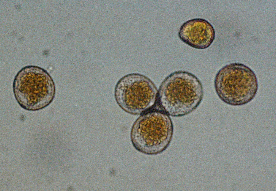 Figure 1b. Urediniospores of P. striiformis = 40x